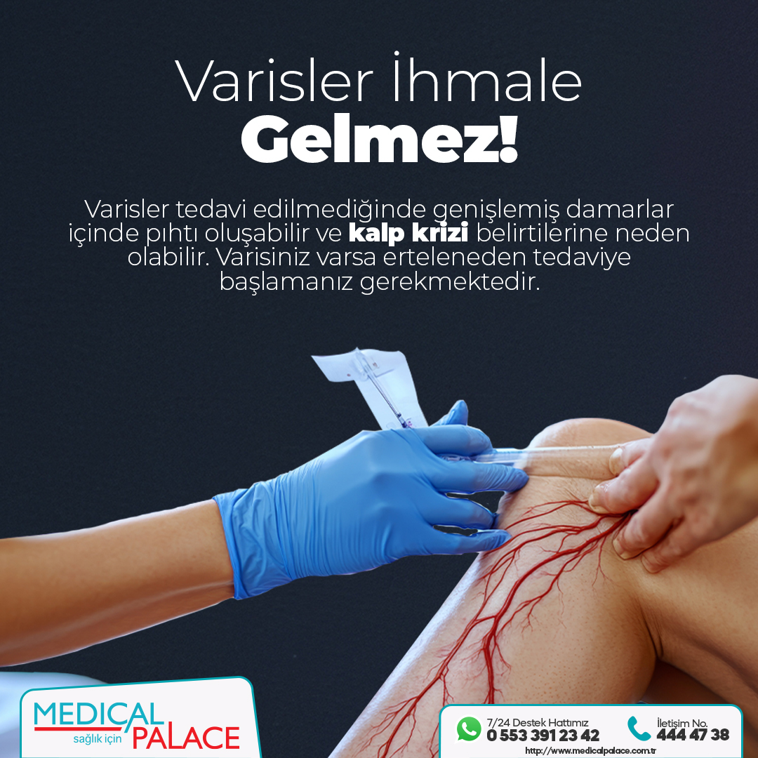 Varisler İhmale Gelmez !!!